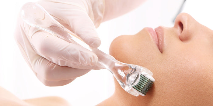 What to Do Before Microneedling